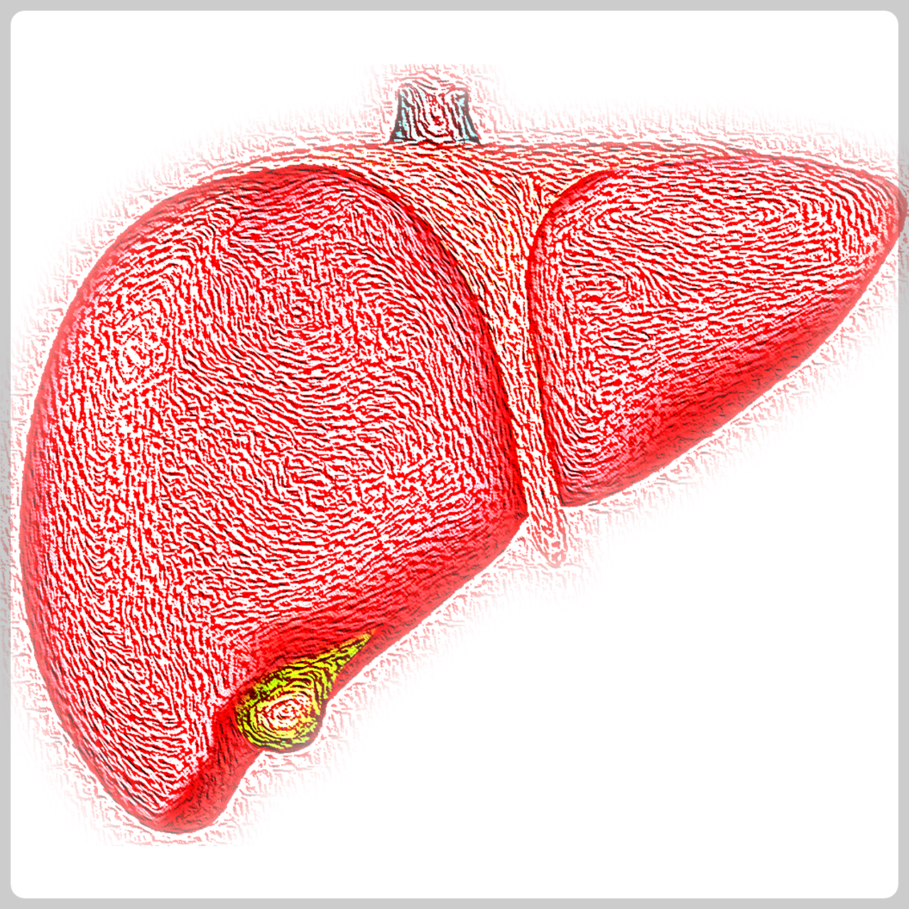 지방간 없애는 방법