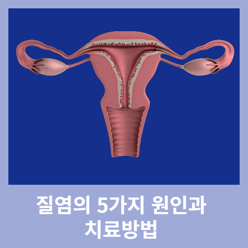 질염