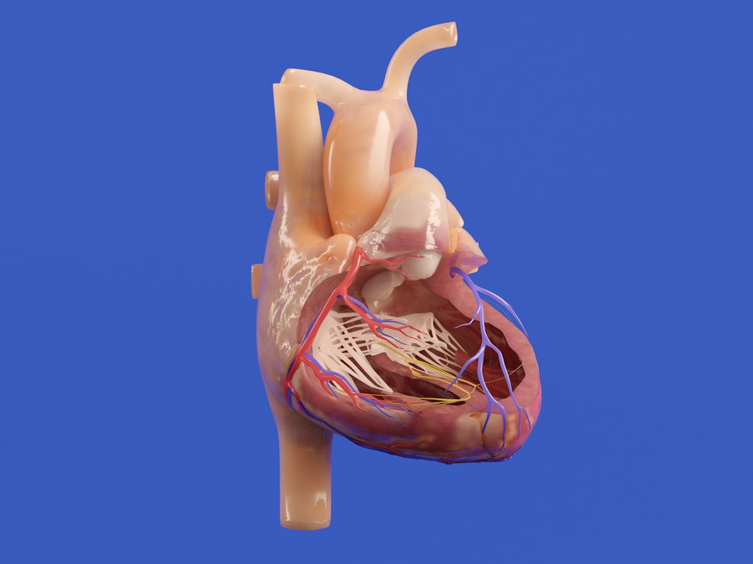Angina