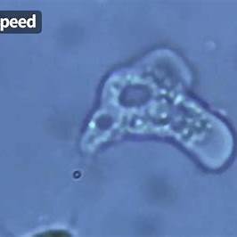 뇌 먹는 아메바 관련 사진