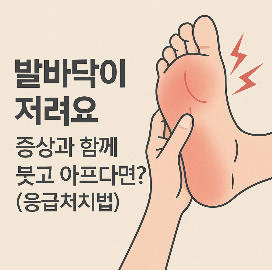 발바닥이저려요 증상과 함께 붓고 아프다면? (응급처치법)