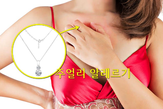 목걸이 안빼고 자면, 피부 가려움증 붉어짐, 목걸이 주얼리 브랜드 추천 티파니, 팁줌