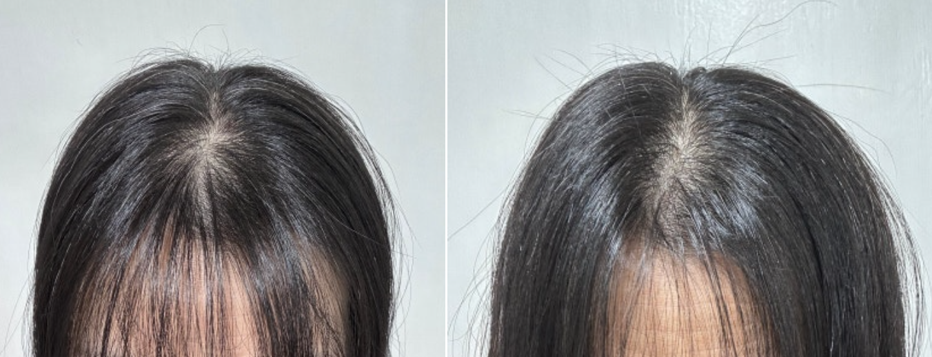 종근당건강 케라넷 내돈내산 후기