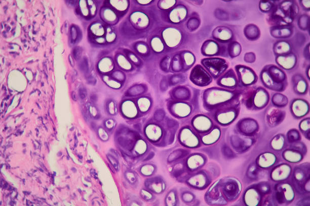 혈당 스파이크 증상 예방