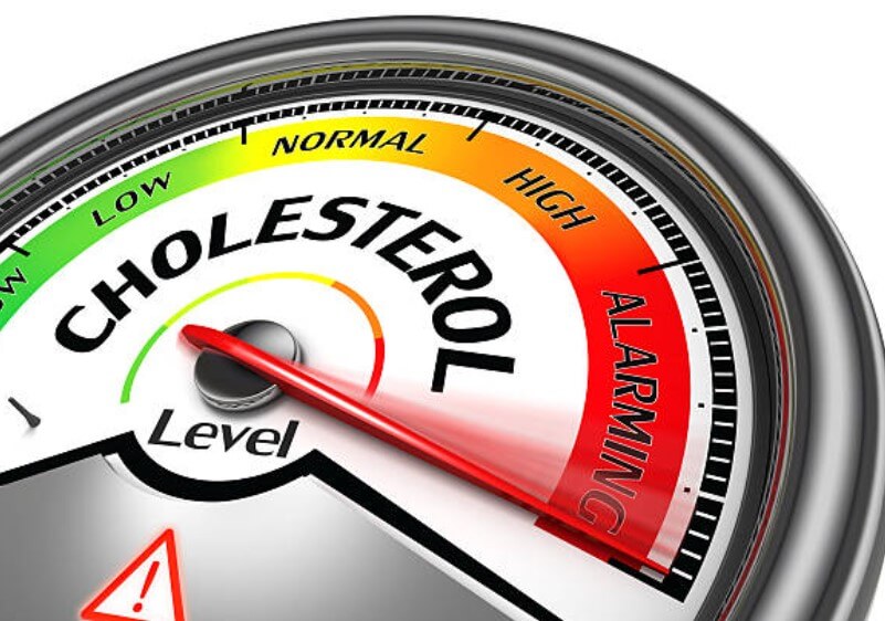 콜레스테롤수치영아기