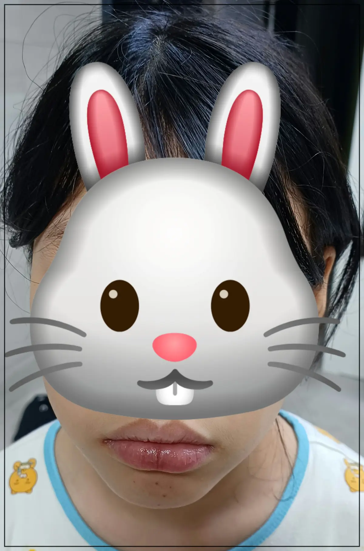 바세린-3일-바른후-사진-입술-매끈해짐