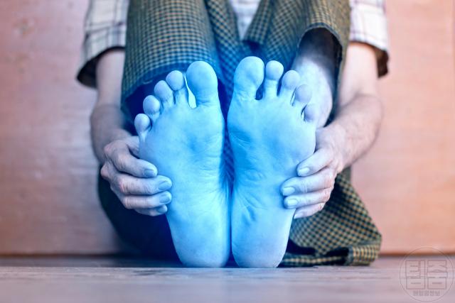 손발 차가움 수족냉증에 좋은 음식