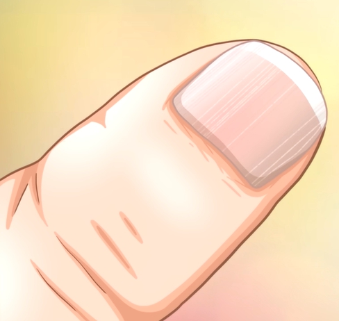 손톱에 세로줄이 생기는 이유