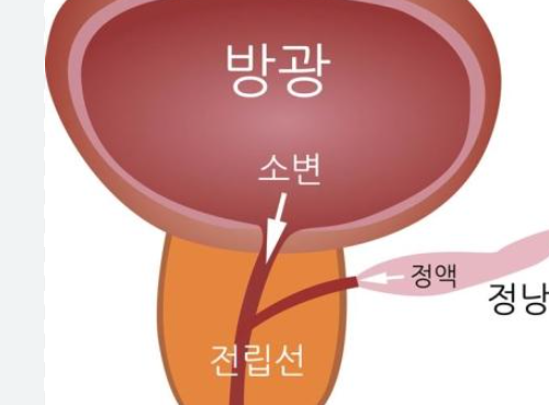전립선에 좋은음식 15가지