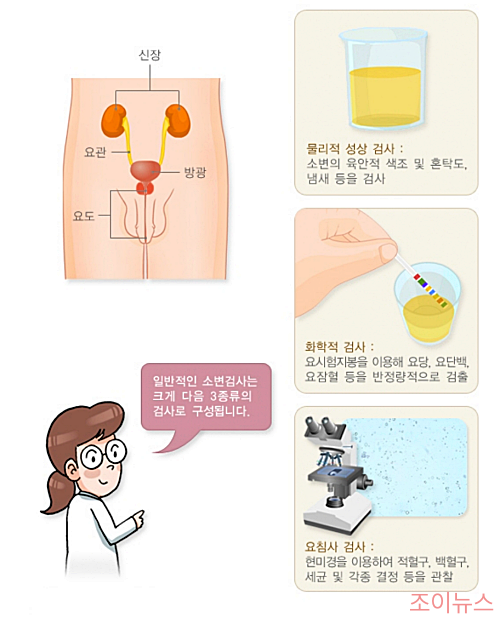 소변검사란?_이미지출처:국가건강정보포털