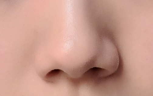 코조각주사 후기