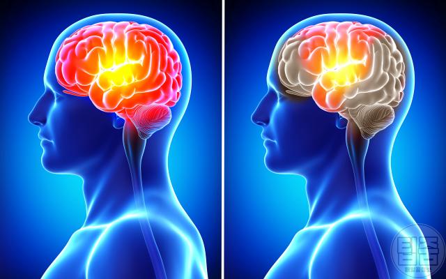 심근경색 전조증상 송대관 사망 원인 현기증 어지러움