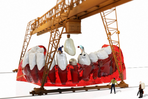 광주 임플란트 가격 싼곳 TOP3 추천 비교