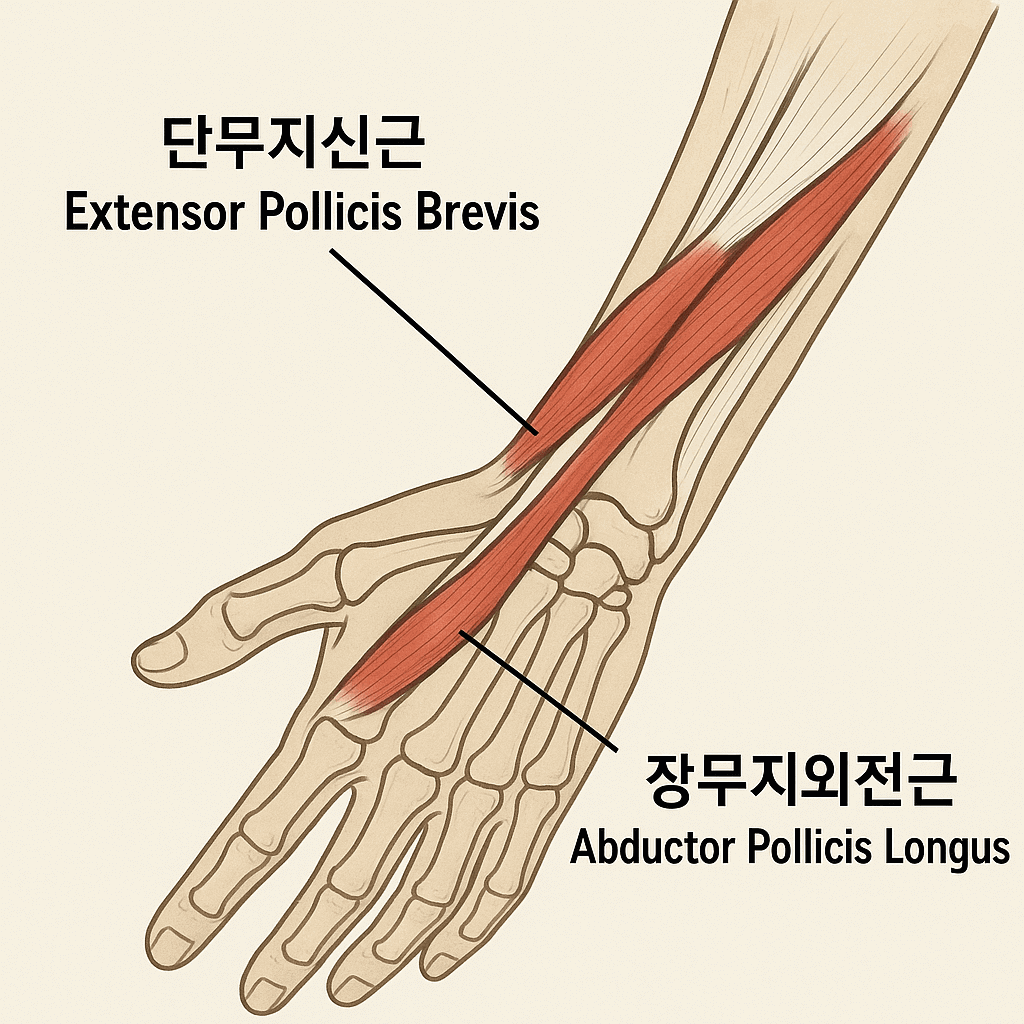 드퀘르벵 증후군 발생 부위와 힘줄 구조