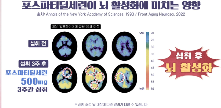 포스파티딜세린 효능