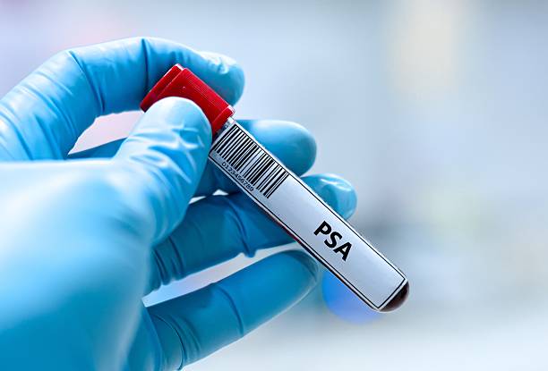 립선 비대증의 진행 단계와 진단