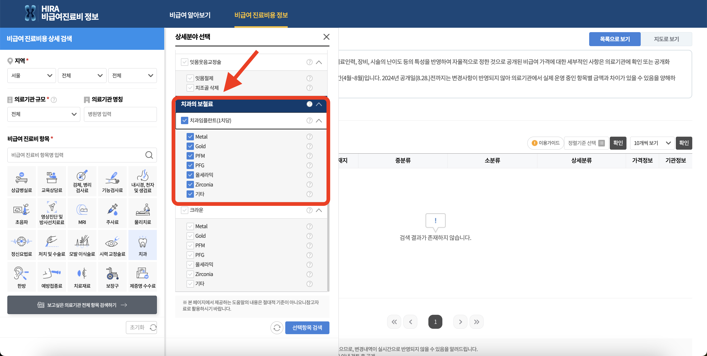임플란트 선택