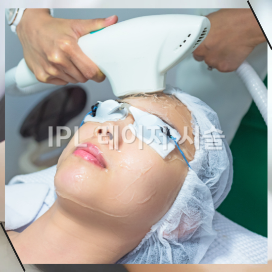 IPL 레이저 시술