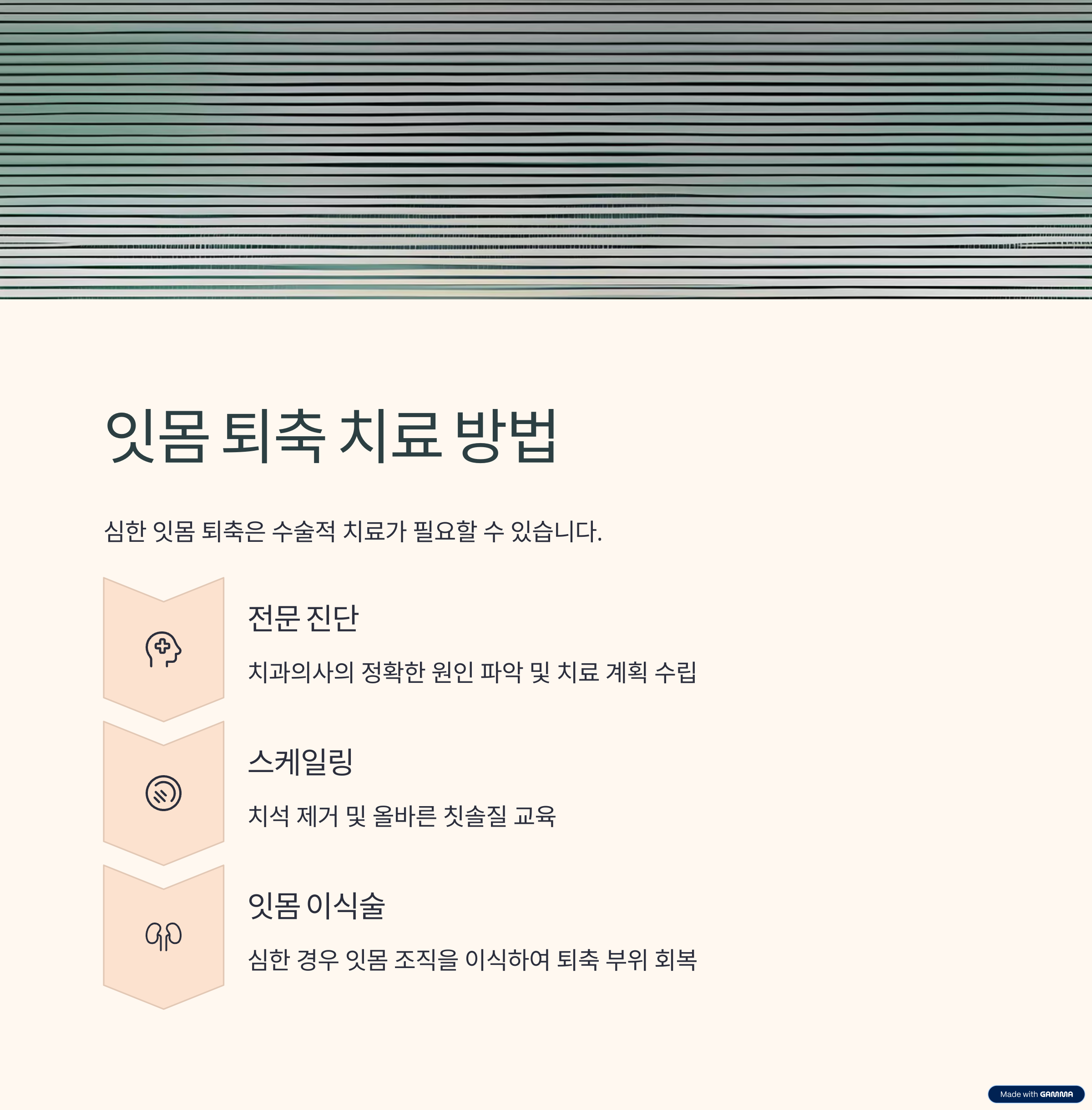 잇몸이 내려앉음 이유? 잇몸 퇴축 원인부터 완벽 예방 &amp; 관리법!