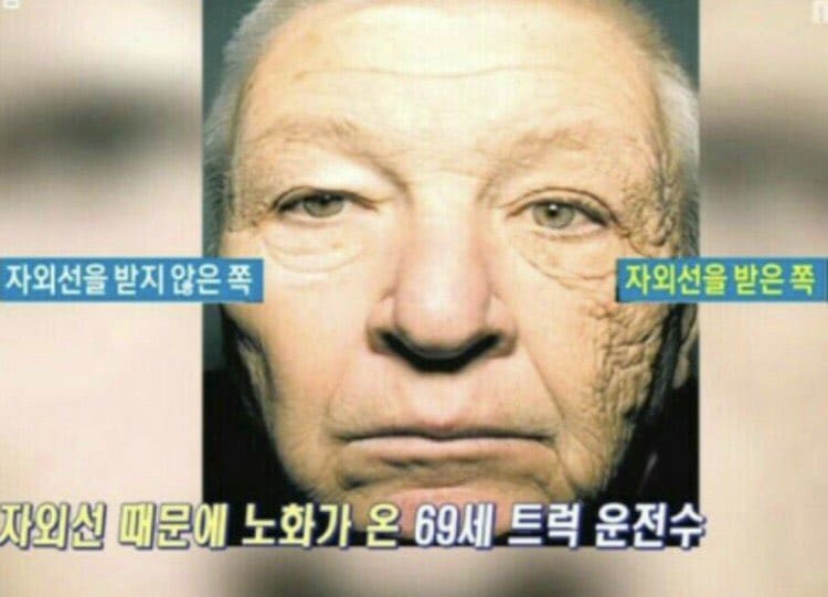 자외선의 영향
