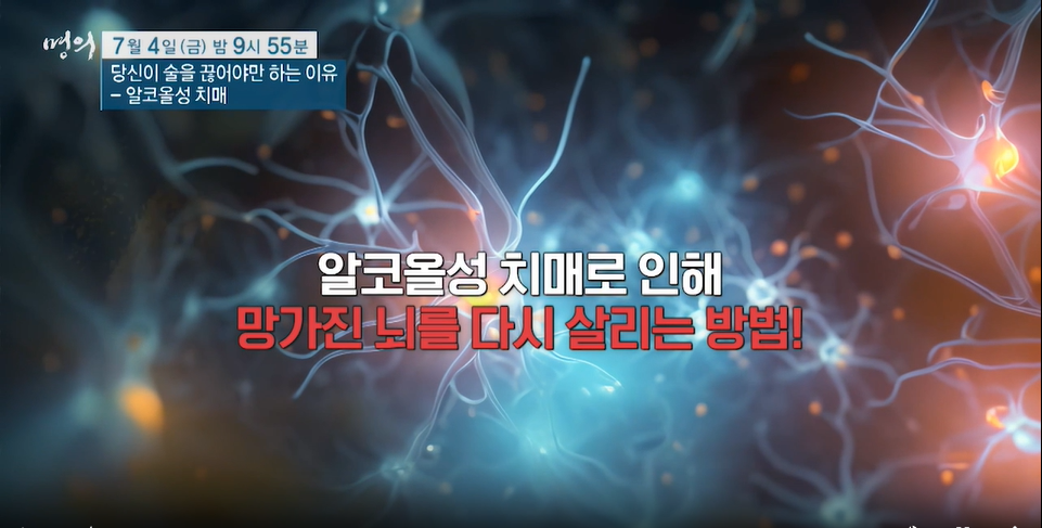 명의 알코올성 치매