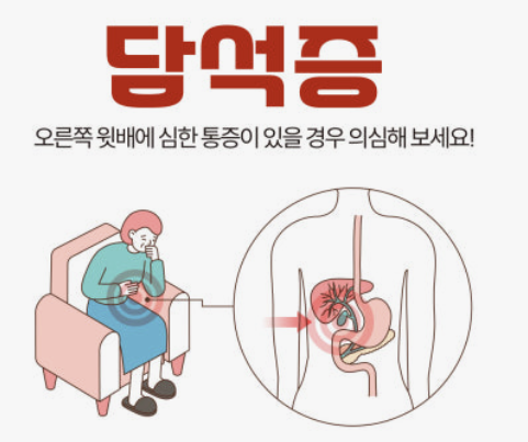 담석 통증, 이렇게 이겨냈어요