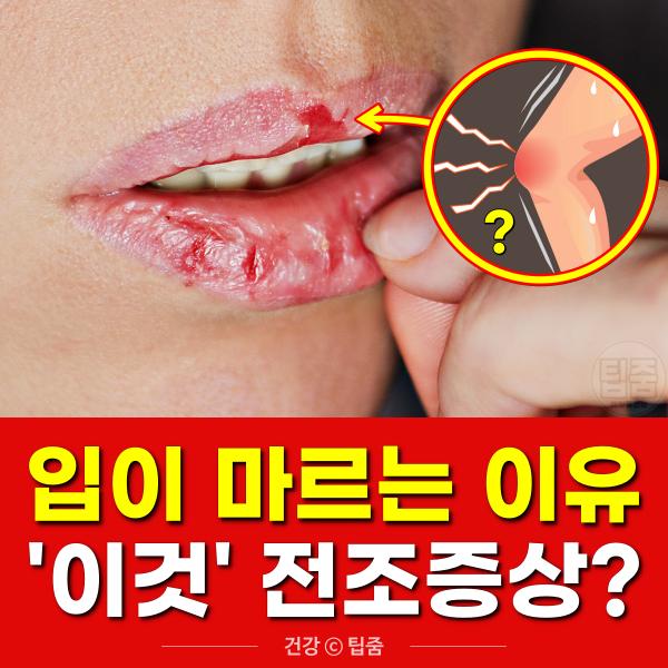 입이 마르는 이유, 입마름 증상, 팁줌