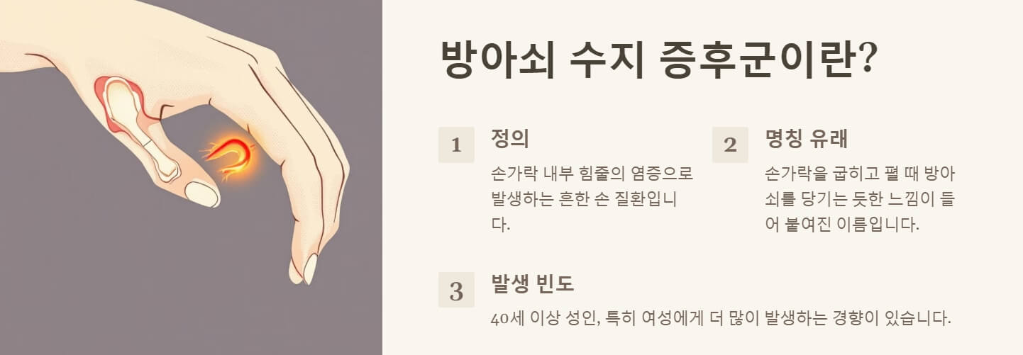 방아쇠 수지 증후근 원인 치료 수술