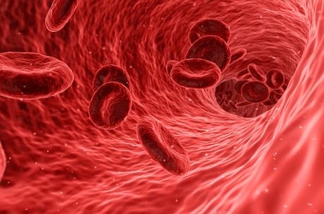 고지혈증에 좋은음식 및 고지혈증 증상
