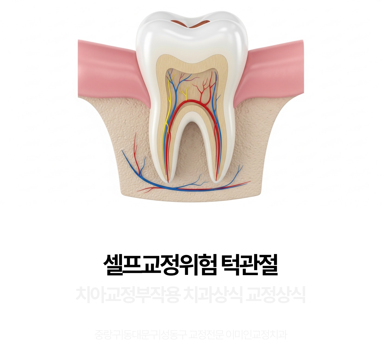 치아교정전문,동대문이미인교정치과,셀프교정위험성