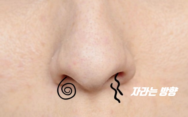 코털 콧털 눈썹 길게 나는 이유,콧털족집게,건강