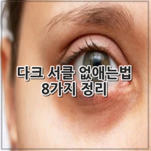 다크 서클 없애는법 8가지 정리