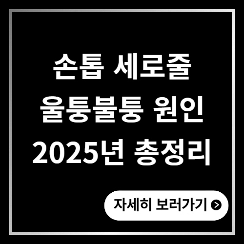 손톱 세로줄 손톱 울퉁불퉁 2025년 원인 총정리 ❘ 손톱 갈라짐 증상 자가진단
