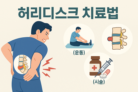 허리디스크 치료법 (운동, 약물, 시술)