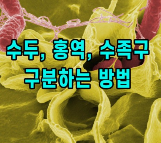 홍역-예방접종