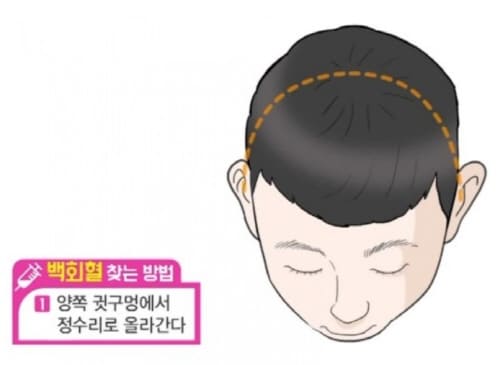 백회혈찾는방법