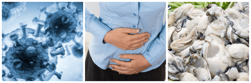 노로바이러스, 복통, 생굴 사진