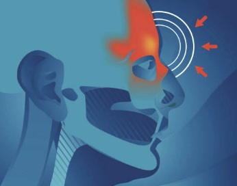 알레르기 비염 원인, 증상, 좋은 음식 소개