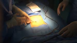 맹장의 위치과 증상