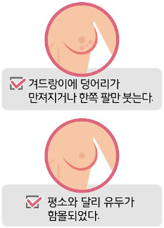 유방암 증상