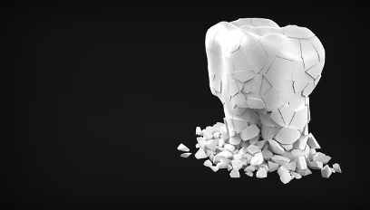 임플란트 시술의 장단점