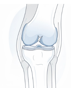 무릎 안쪽 통증 원인