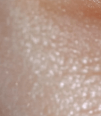 눈밑에 하얀 좁쌀