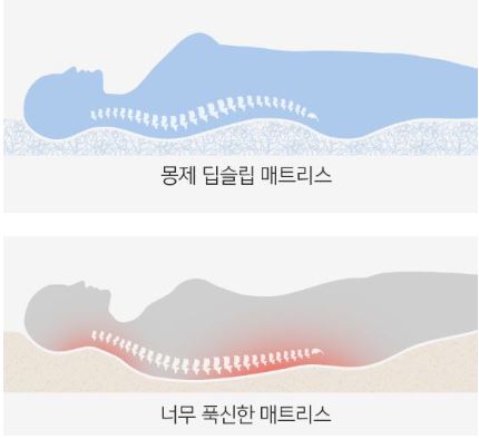 몽제 매트리스 단점