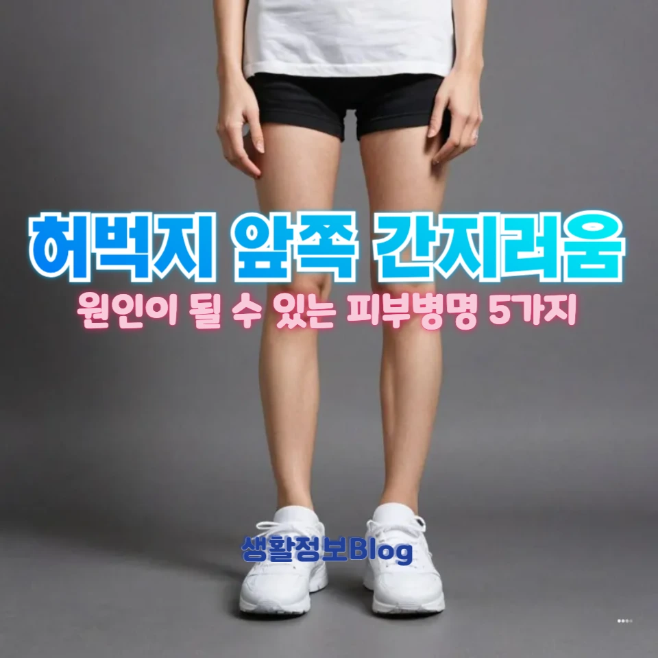 허벅지 앞쪽 간지러움과 오돌토돌한 피부병