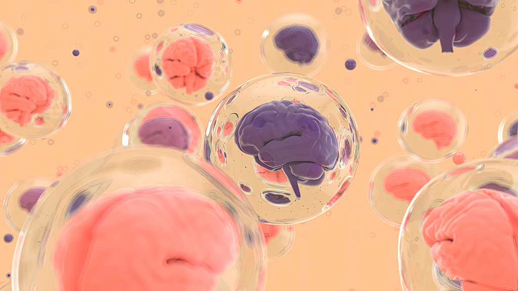 보라, 분홍색깔의 인간의 뇌들이 각각의 방울 속에서 떠다니는 이미지