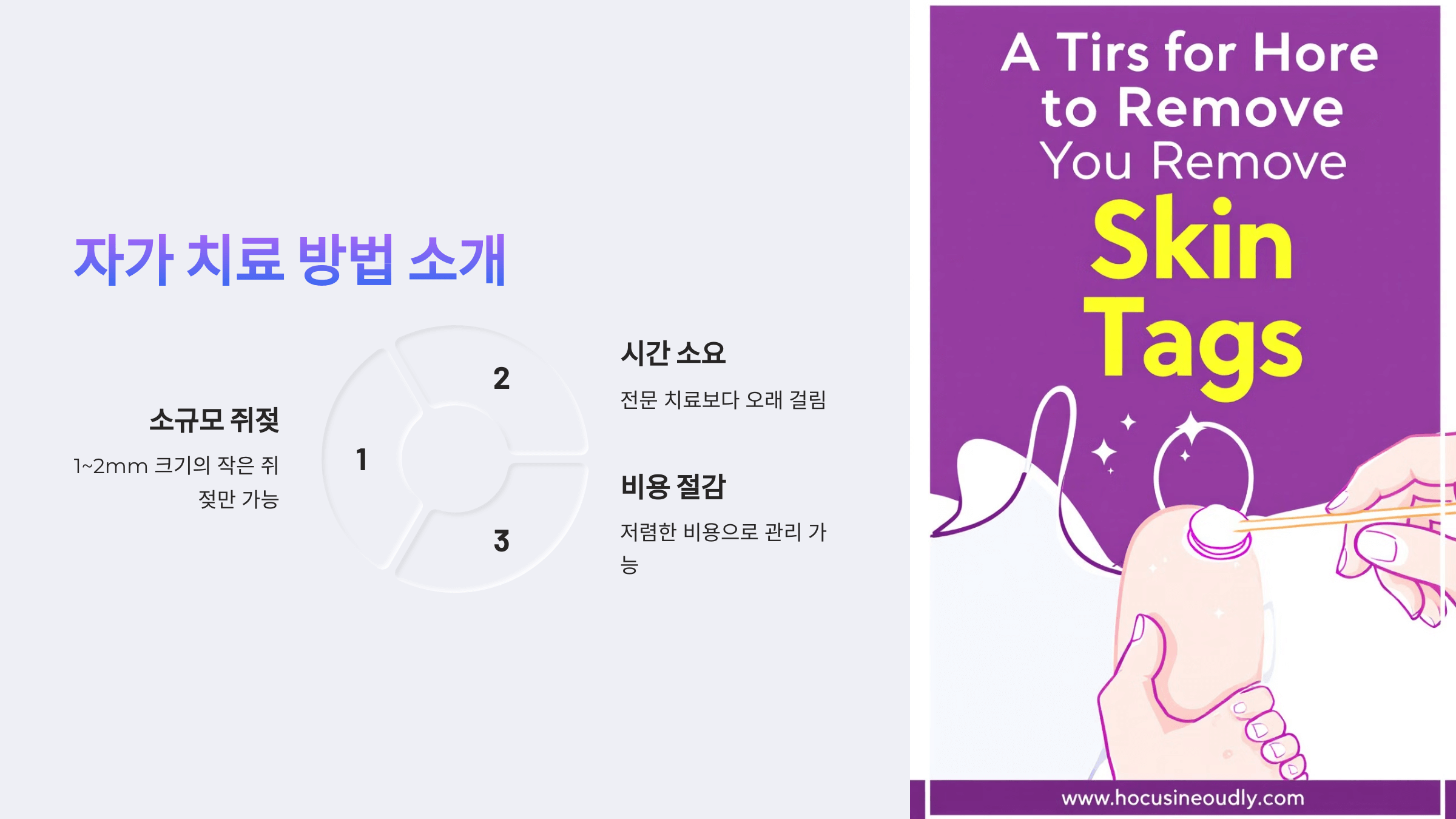 쥐젖과 관련된 사진입니다.