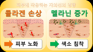 팔꿈치 착색
