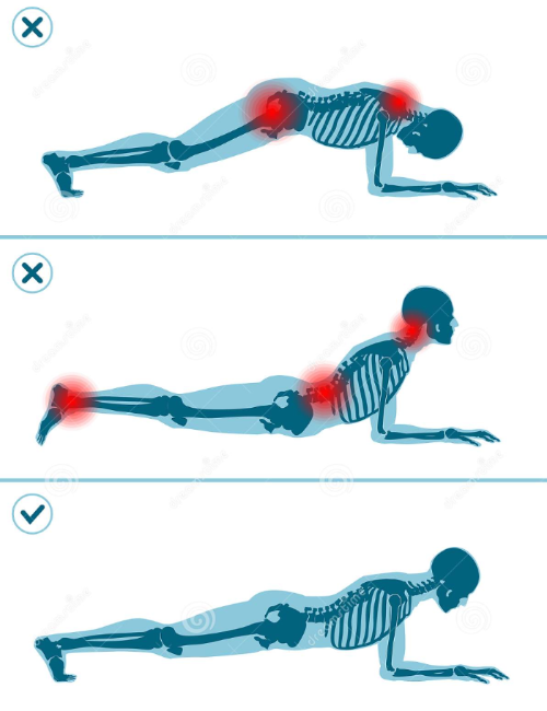 잘못된-플랭크-자세는-부작용을-유발할-수-있습니다.