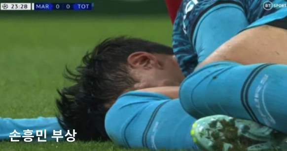 손흥민 얼굴 부상